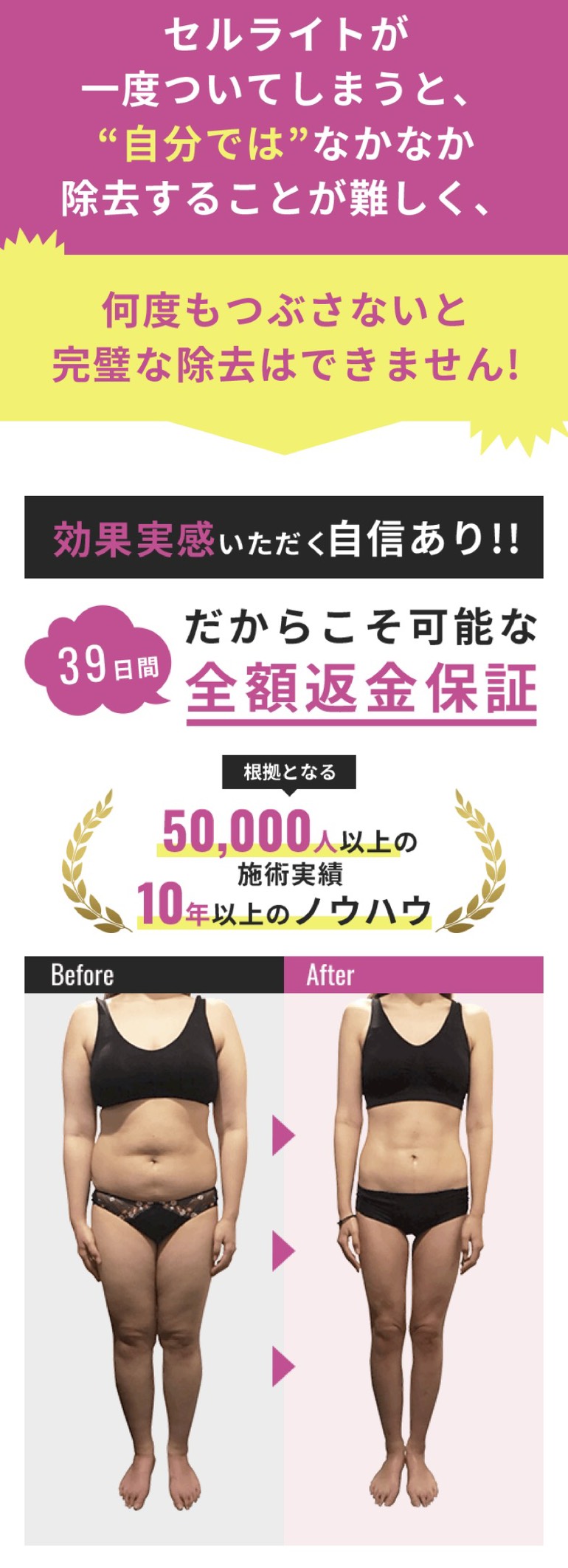 パーフェクトライン