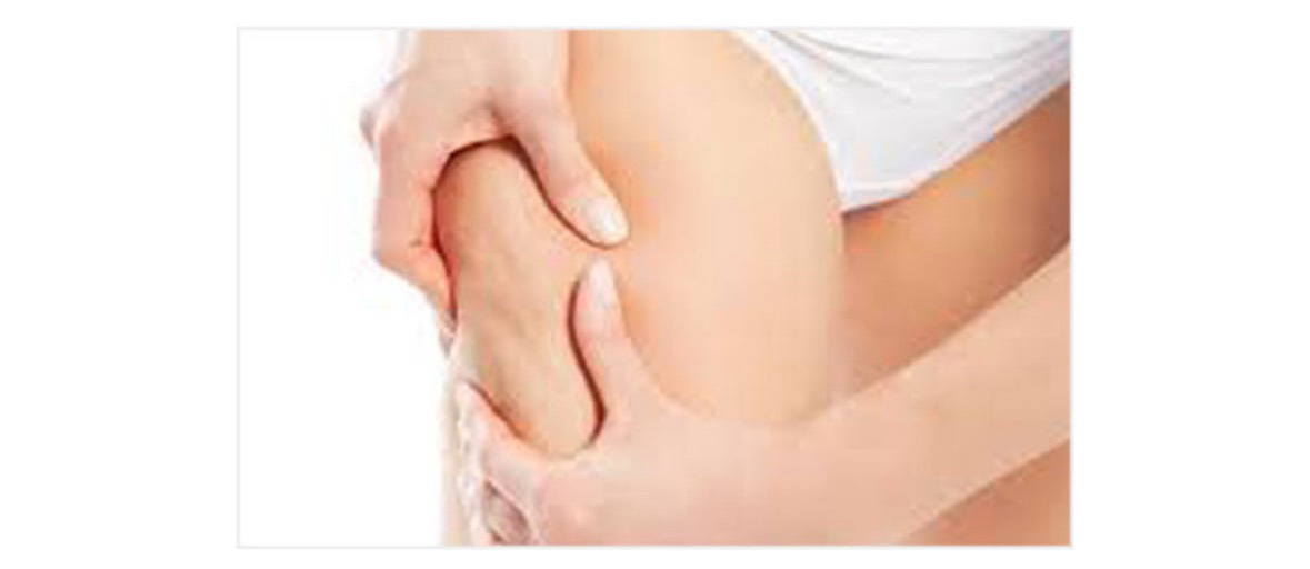 パーフェクトライン