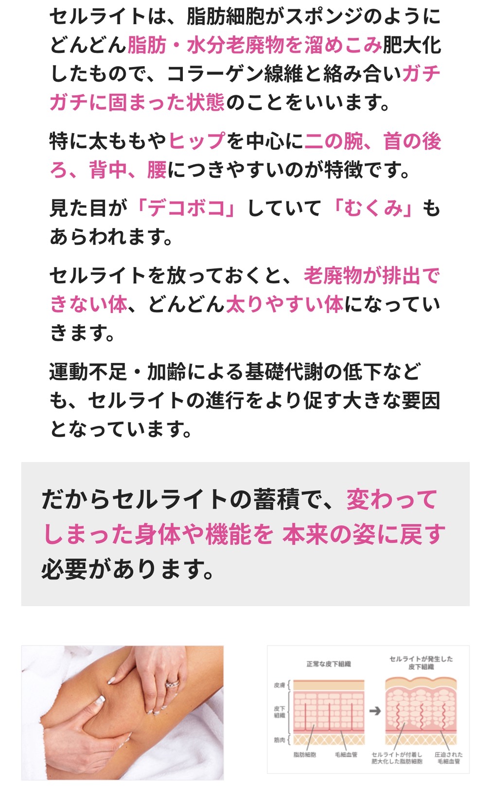 パーフェクトライン